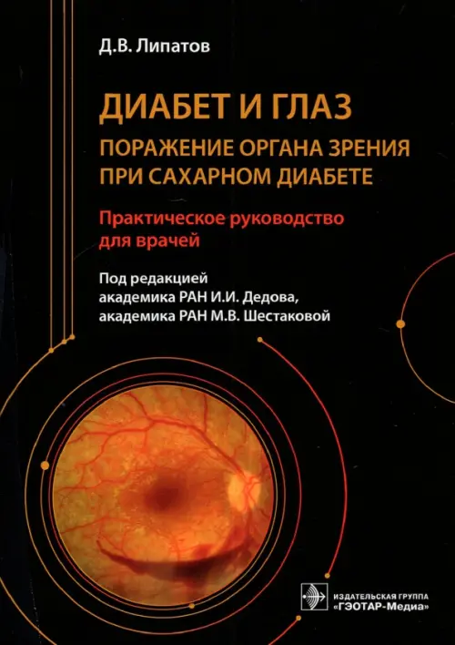 Диабет и глаз. Поражение органа зрения при сахарном диабете, 4467.00 руб