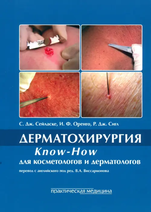 Дерматохирургия. Know-How для косметологов и дерматологов.