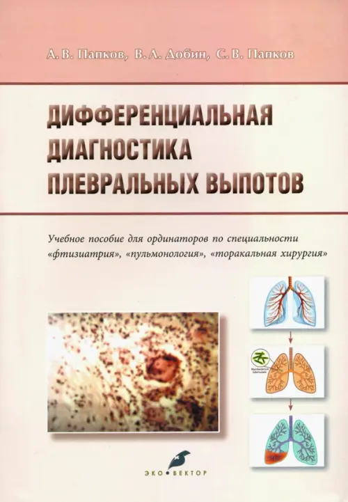 Дифференциальная диагностика плевральных выпотов. Учебное пособие, 594.00 руб