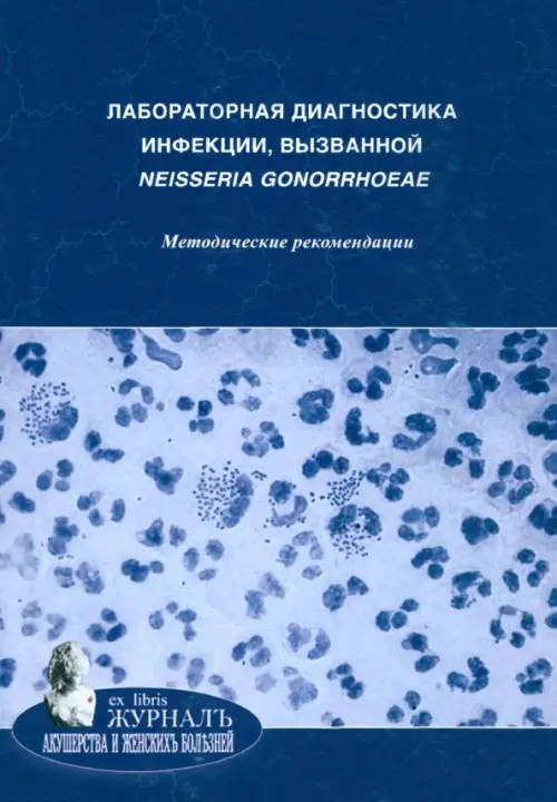 Лабораторная диагностика инфекции, вызванной neisseria gonorrhoeae. Методические рекомендации, 117.00 руб