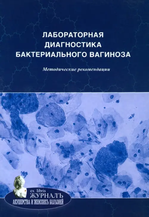 Лабораторная диагностика бактериального вагиноза. Методические рекомендации, 117.00 руб