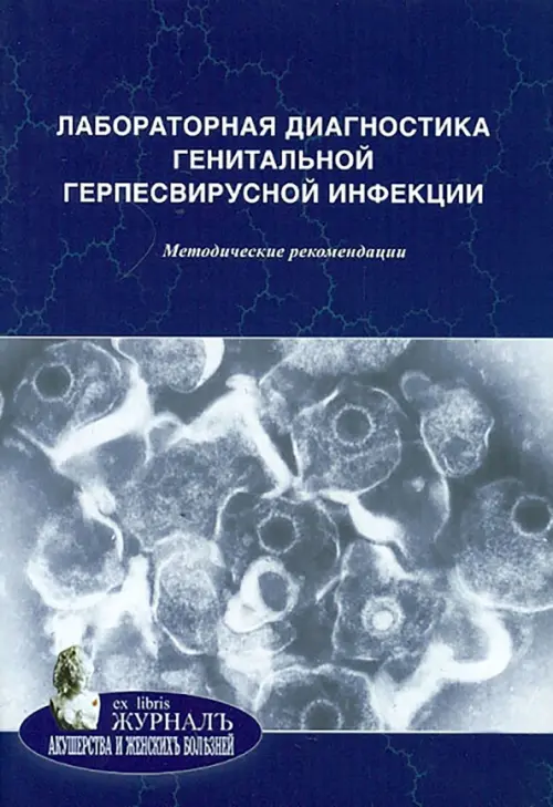 Лабораторная диагностика генитальной герпесвирусной инфекции. Методические рекомендации, 117.00 руб