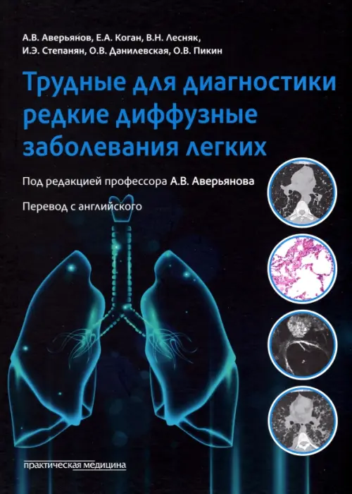 Трудные для диагностики редкие диффузные заболеваниях легких, 5320.00 руб