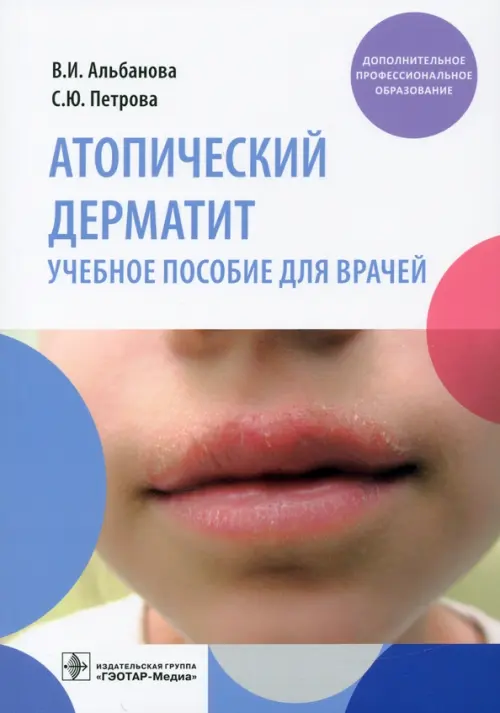Атопический дерматит. Учебное пособие для врачей, 1370.00 руб