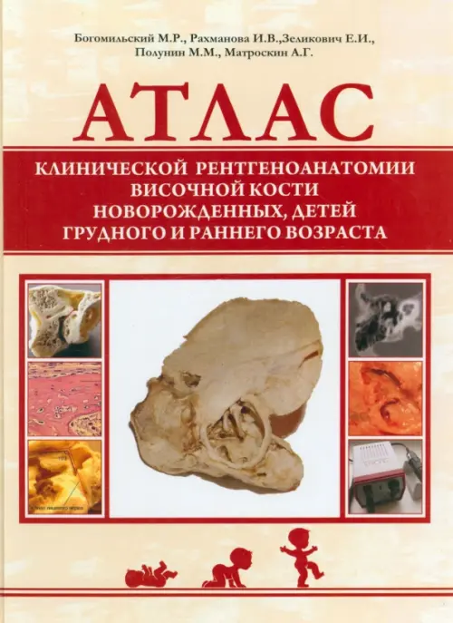 Атлас клинической рентгеноанатомии височной кости новорожденных, 1885.00 руб