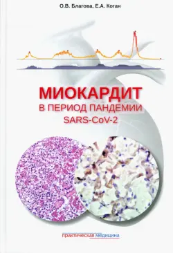 Миокардит в период пандемии SARS-CoV-2
