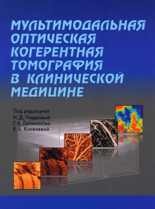 Мультимодальная оптическая когерентная томография в клинической медицине, 1610.00 руб
